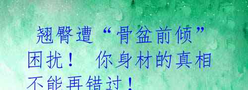  翘臀遭“骨盆前倾”困扰！ 你身材的真相不能再错过！
