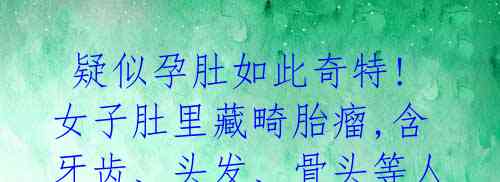  疑似孕肚如此奇特!女子肚里藏畸胎瘤,含牙齿、头发、骨头等人体组织