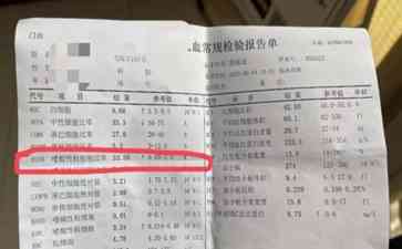  顺德鱼生吃出肝吸虫病, 近日陆军军医大学专家提醒注意