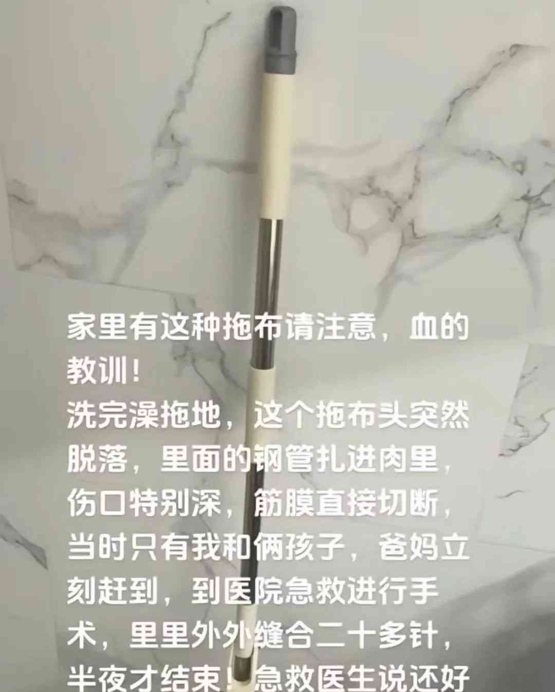 最新曝光事件--网友称被拖把杆切断筋膜缝合20多针