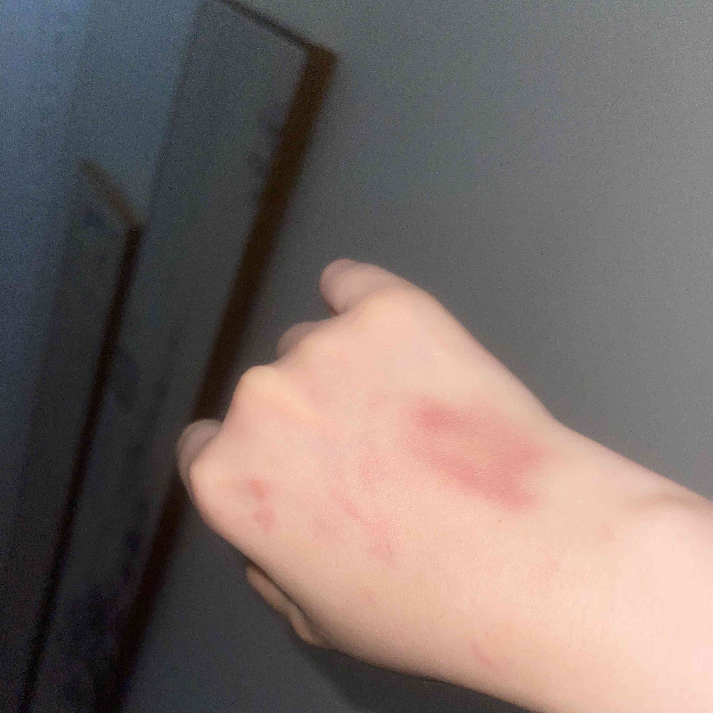 引发广泛关注:狗尾巴扫到对方腿 狗主人遭殴打