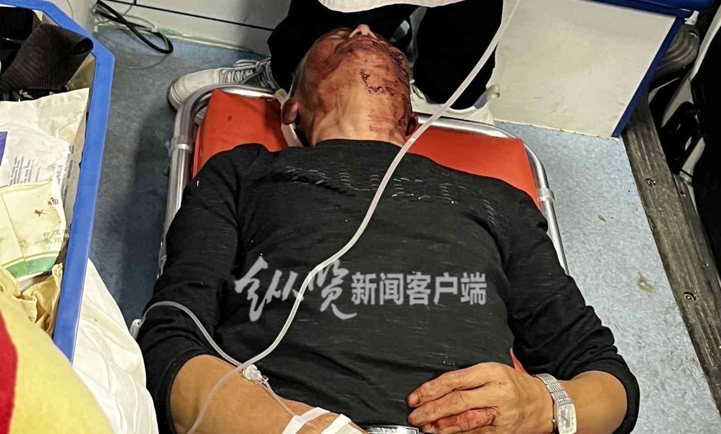 最新爆炸性新闻:毕节公职人员打老人？官方称或互殴