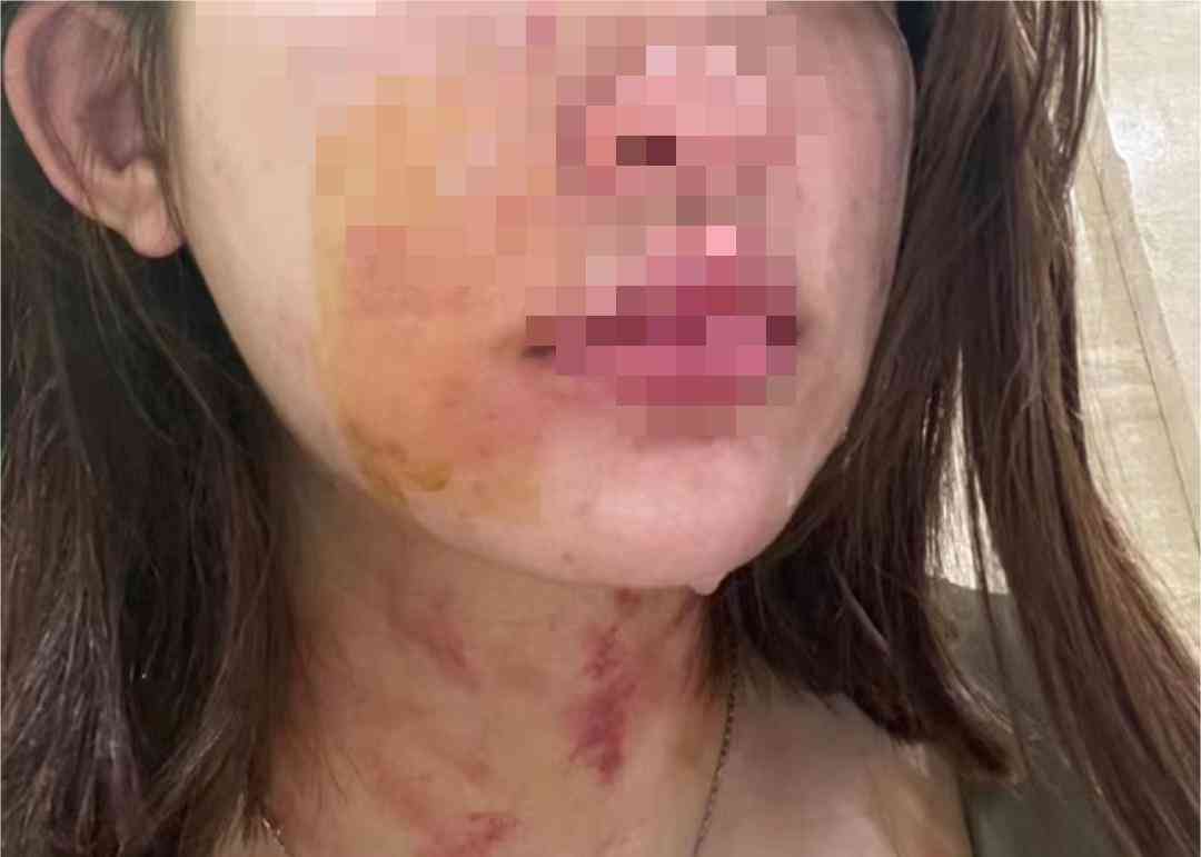 最新内幕曝光：女子牵狗进电梯遭殴打？妇联回应