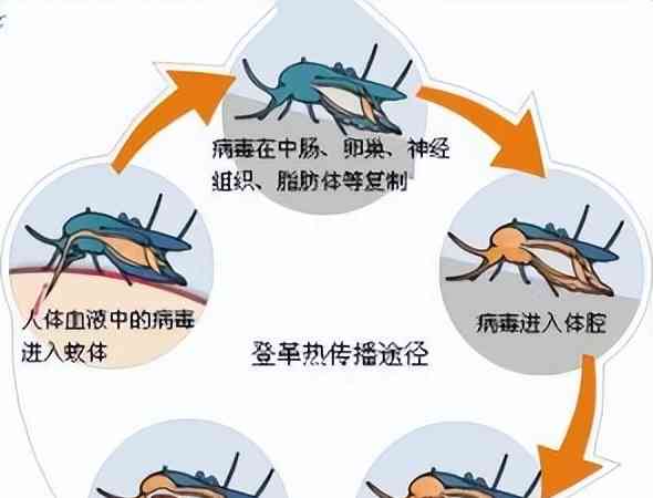 最新内幕曝光。有夫妻双双确诊登革热 疾控提醒