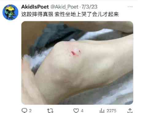  饥饿诅咒下的中国留学生