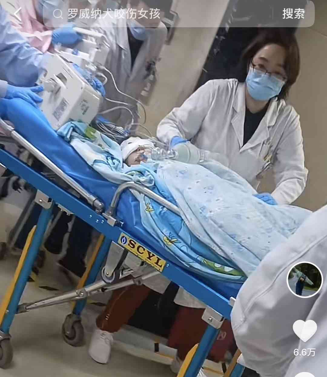  成都崇州大型犬伤害幼童，主人遭刑拘！幼童现状如何？
