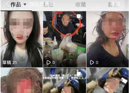 女子遭殴打！拒绝男子骚扰后头部流血，警方介入调查