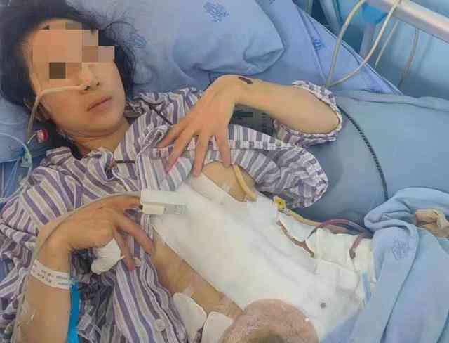  女子家暴16次 宣告终身负重,社交媒体呼吁零家暴