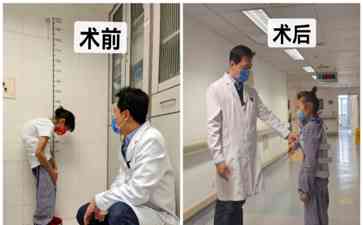 镜报：20年来“反向折叠人”终于找到伸直自己的自由！
