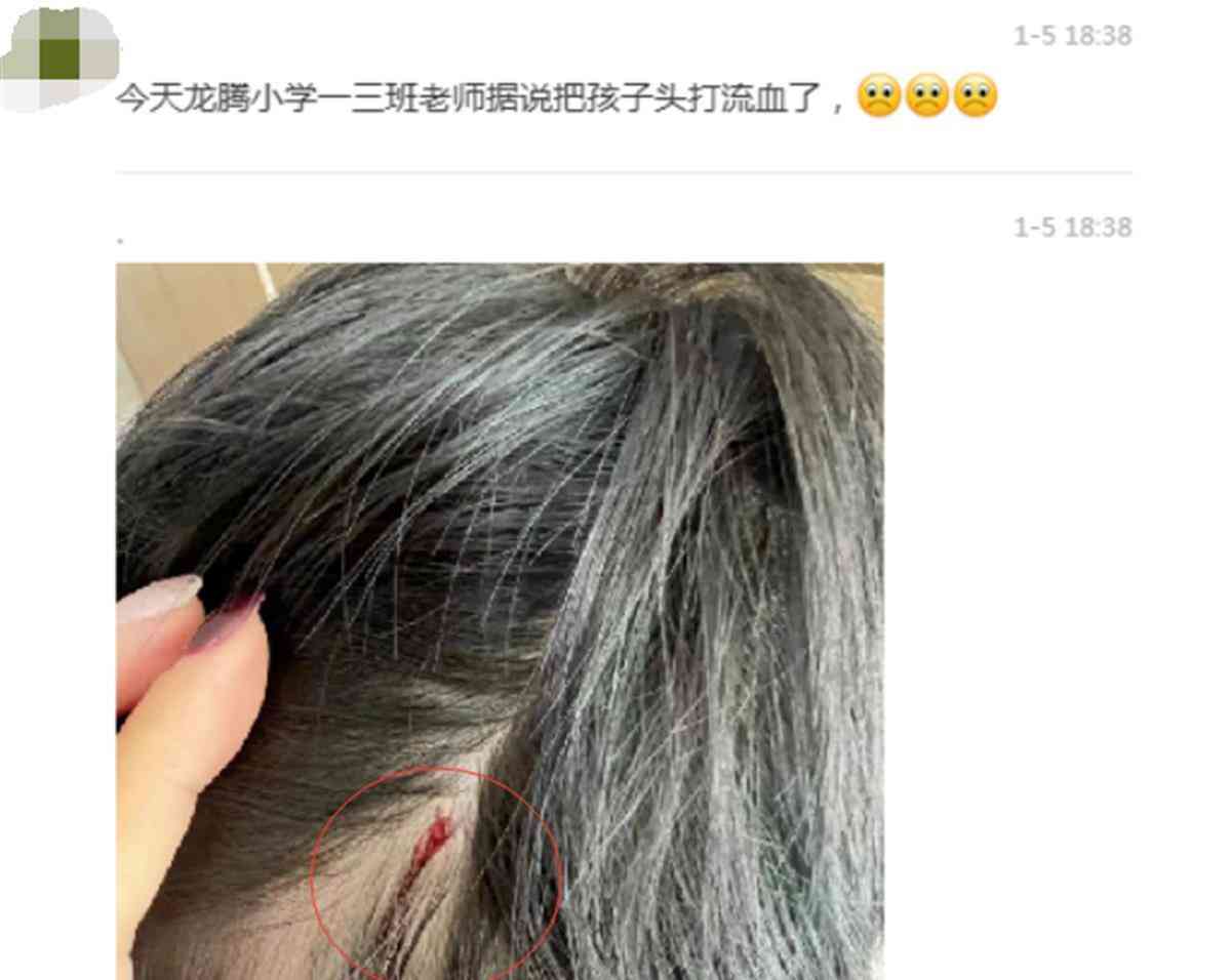  郑州小学老师打破学生头部引发家长集体控诉